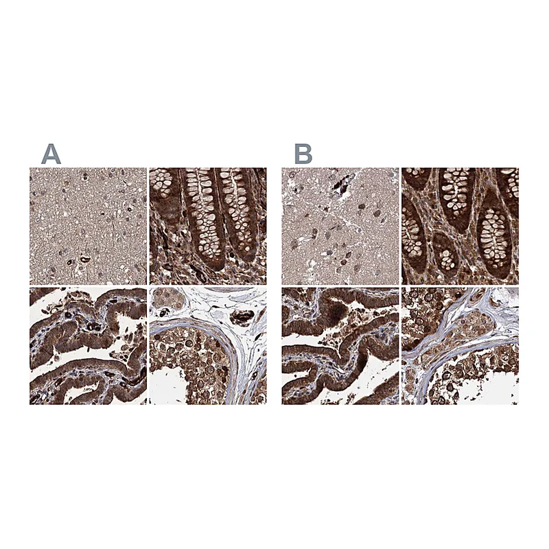 Atlas Antibodies Anti-RPAP3 Antibody