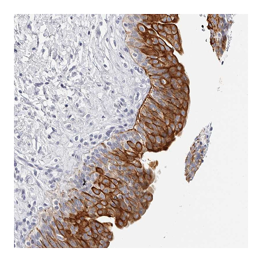 Atlas Antibodies Anti-RPH3AL Antibody