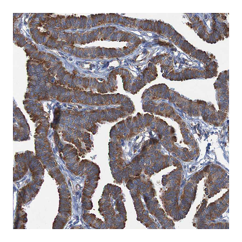 Atlas Antibodies Anti-RPL10 Antibody
