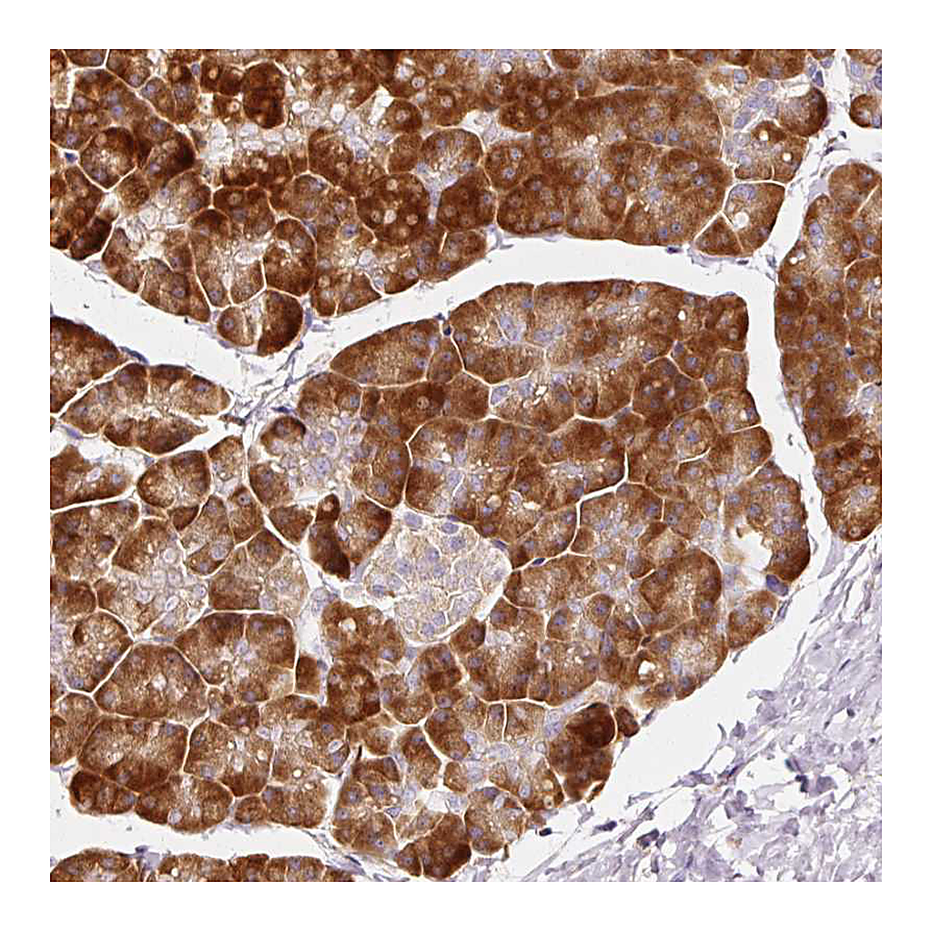 Atlas Antibodies Anti-RPL10A Antibody