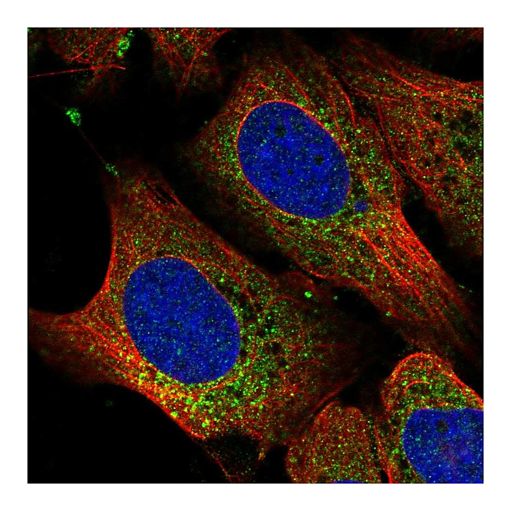Atlas Antibodies Anti-RPL11 Antibody