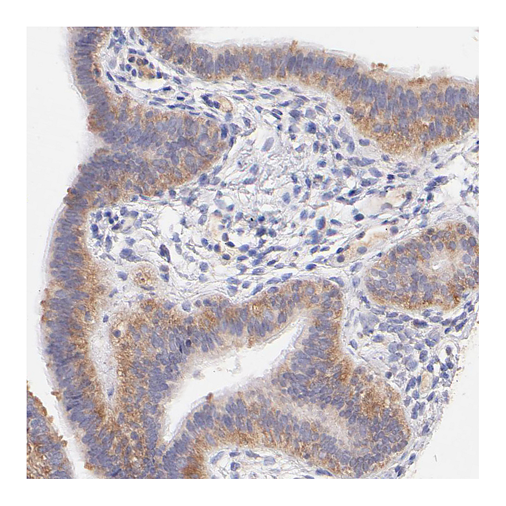 Atlas Antibodies Anti-RPL11 Antibody