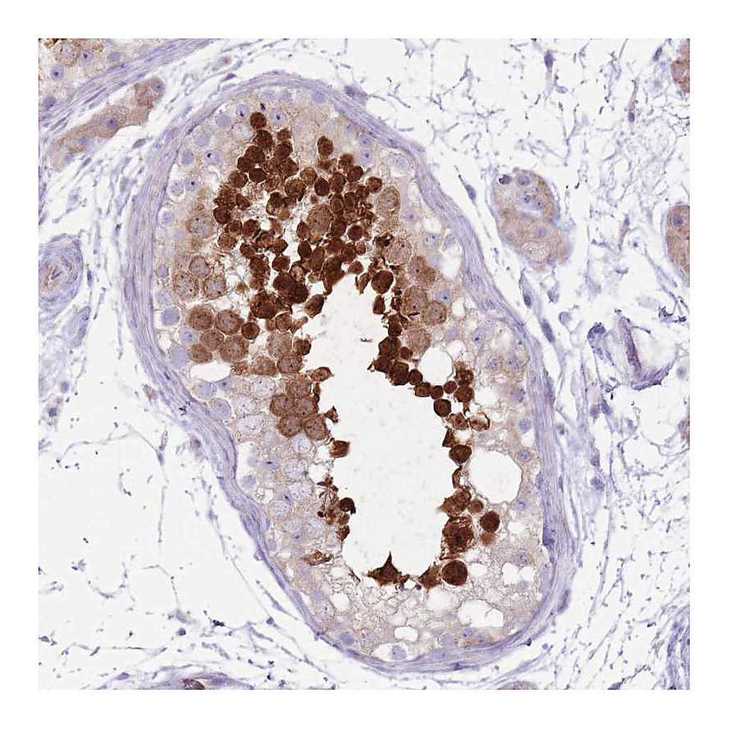 Atlas Antibodies Anti-RPL18 Antibody