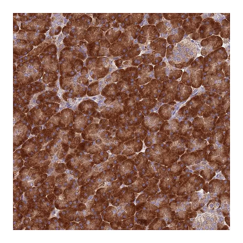 Atlas Antibodies Anti-RPL17 Antibody