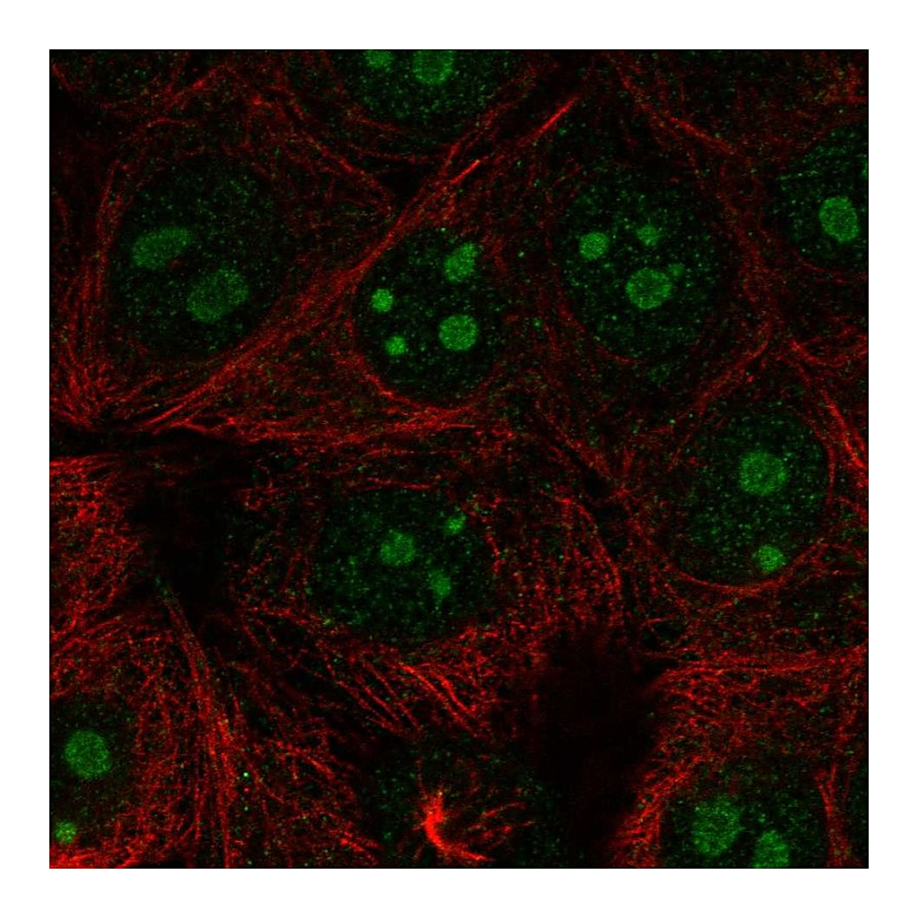 Atlas Antibodies Anti-RPL22L1 Antibody