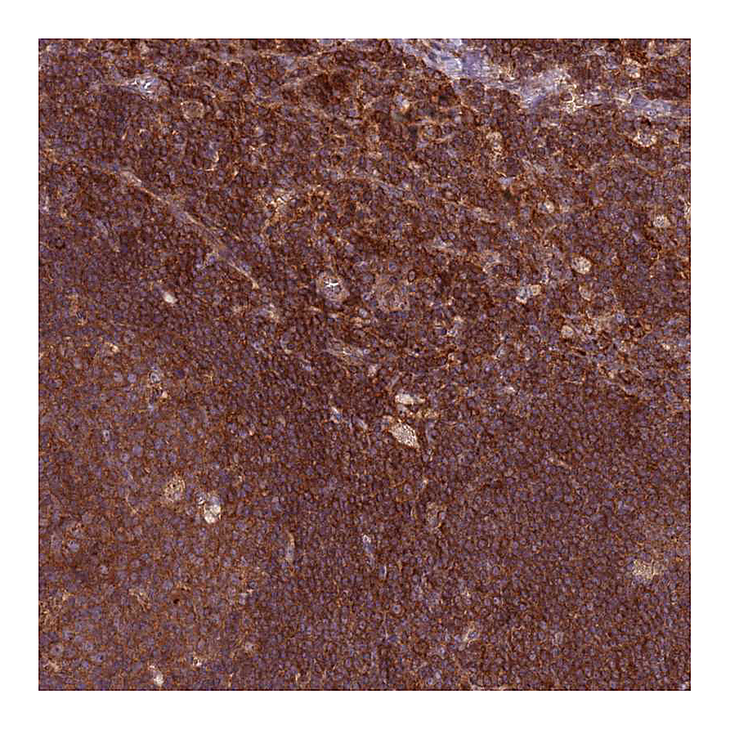 Atlas Antibodies Anti-RPL21 Antibody