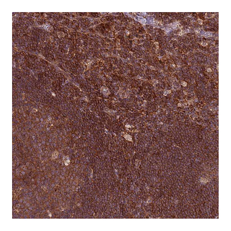Atlas Antibodies Anti-RPL21 Antibody