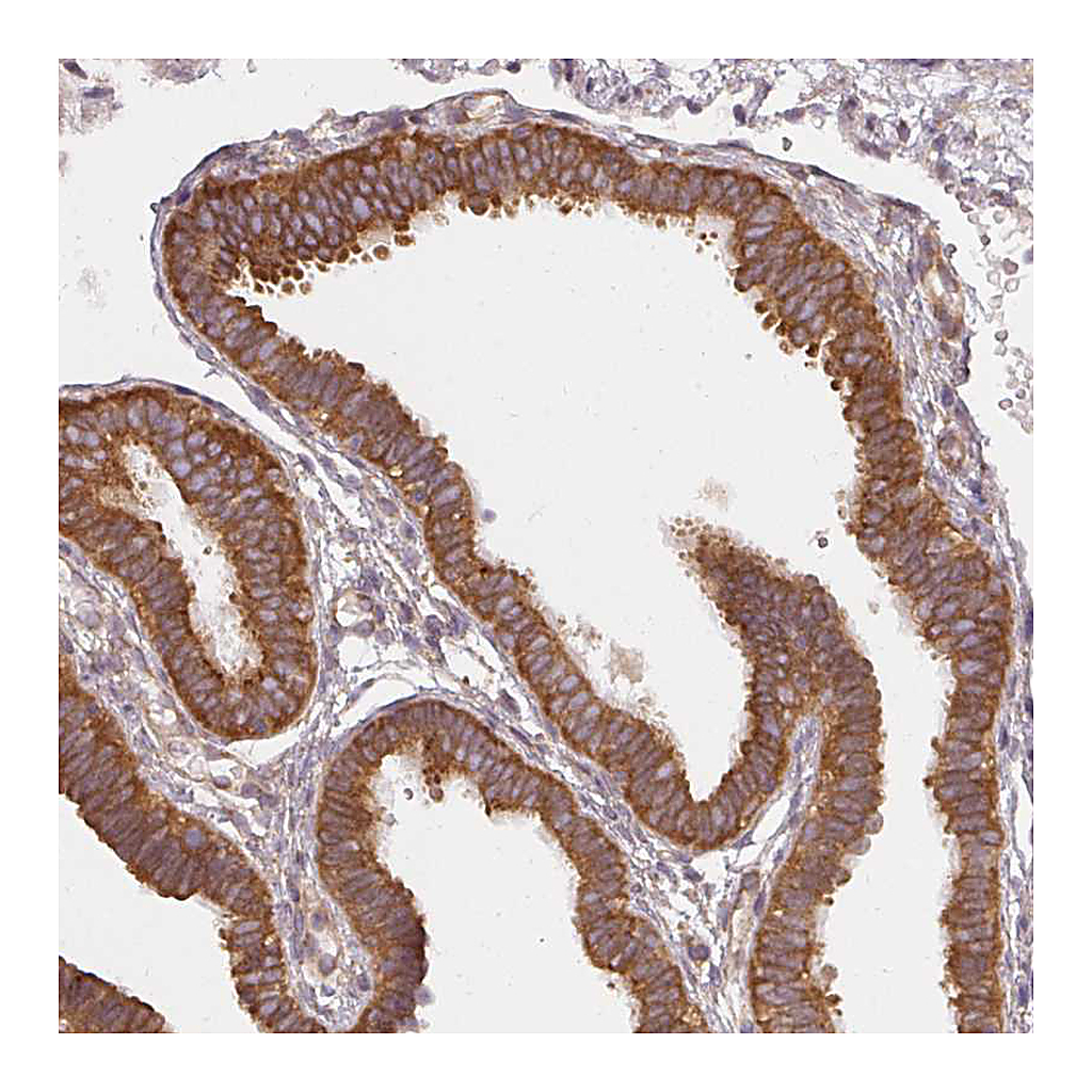 Atlas Antibodies Anti-RPL24 Antibody
