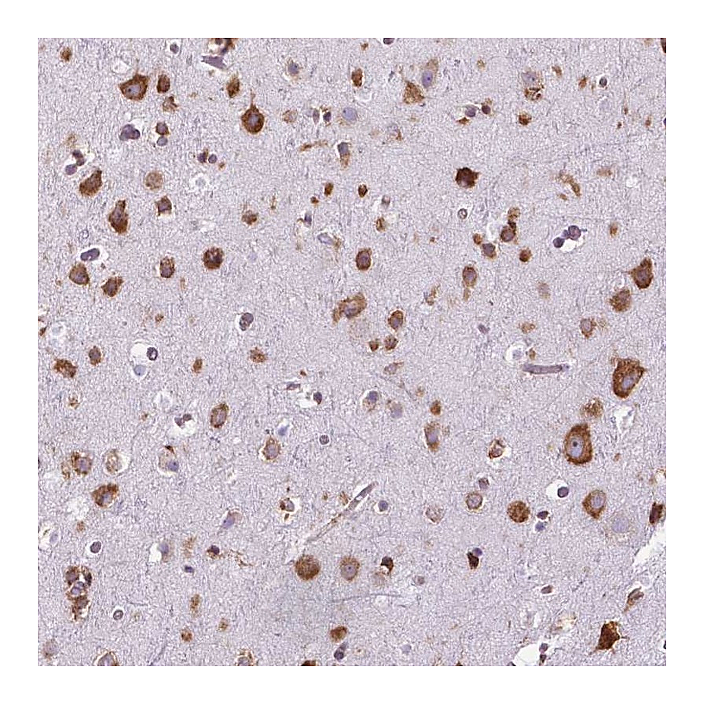 Atlas Antibodies Anti-RPL29 Antibody