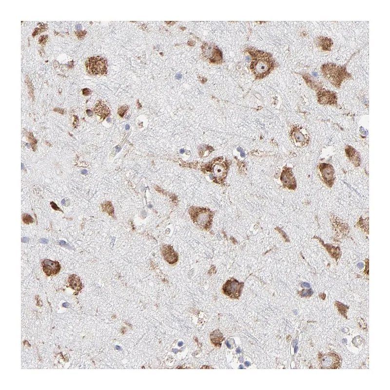 Atlas Antibodies Anti-RPL3 Antibody