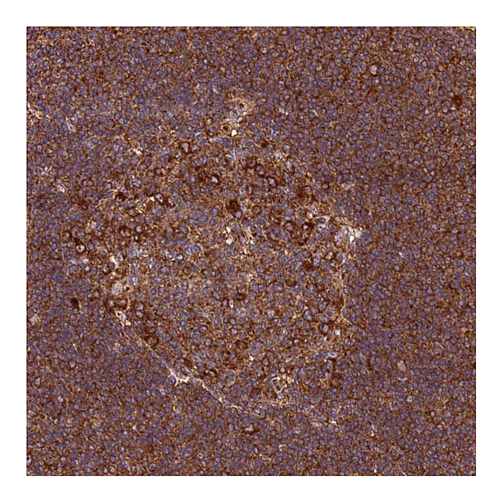 Atlas Antibodies Anti-RPL36 Antibody