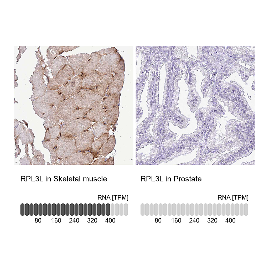 Atlas Antibodies Anti-RPL3L Antibody