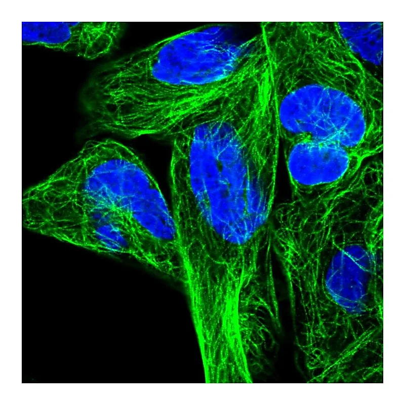 Atlas Antibodies Anti-RPL6 Antibody