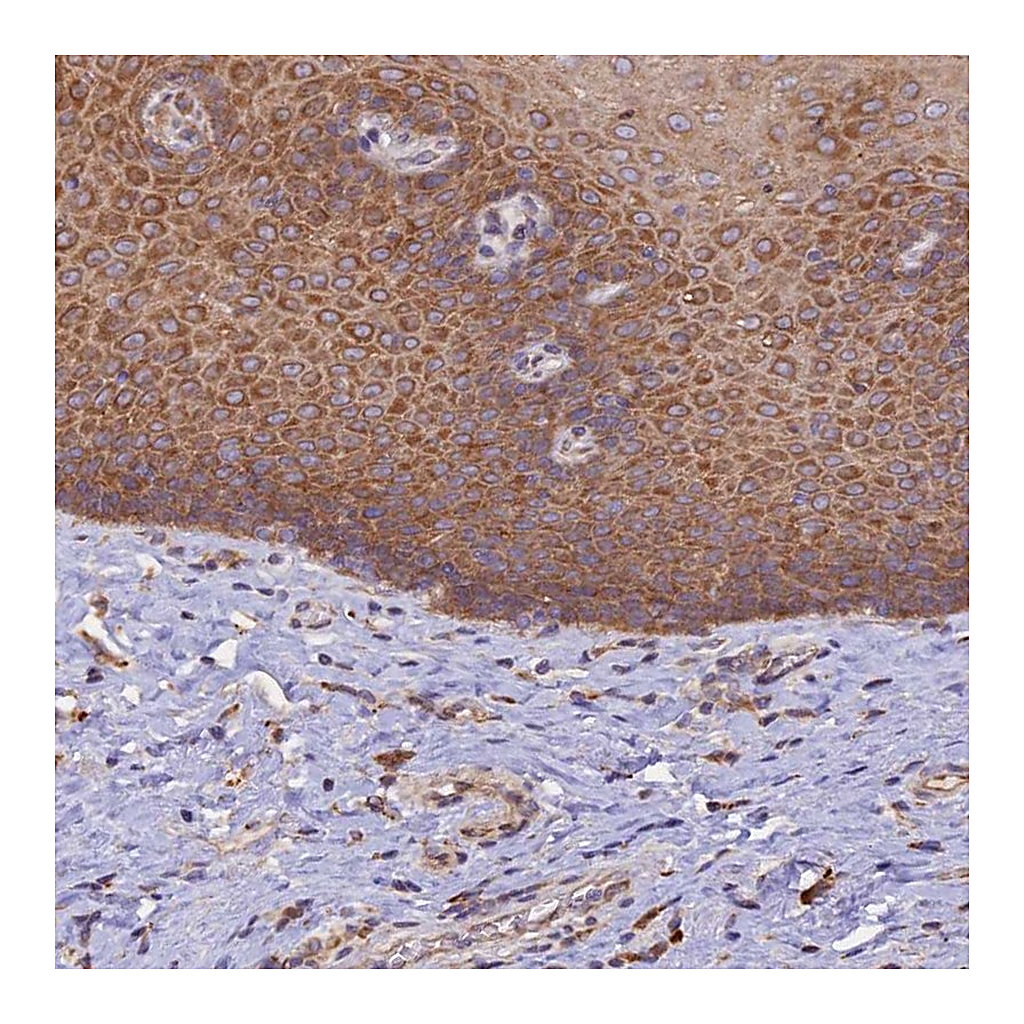 Atlas Antibodies Anti-RPL5 Antibody