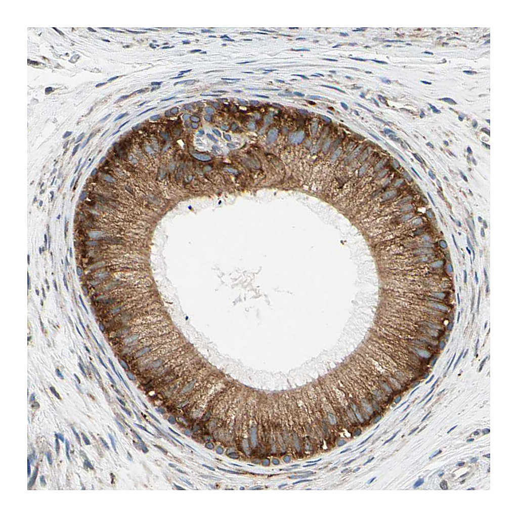 Atlas Antibodies Anti-RPN2 Antibody