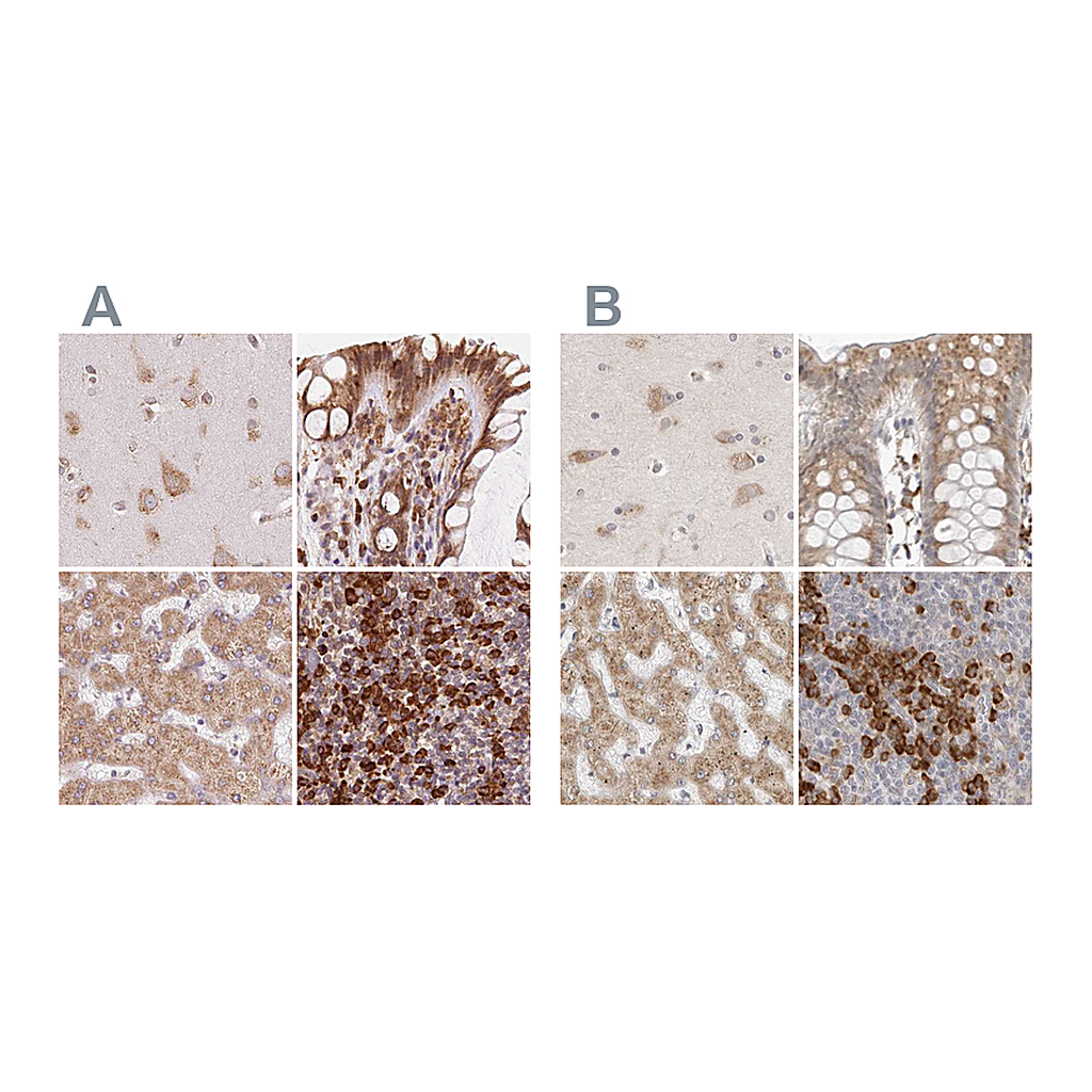 Atlas Antibodies Anti-RPN1 Antibody