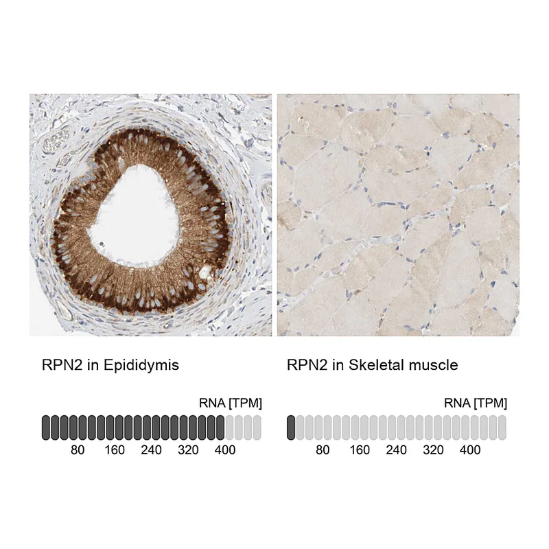 Atlas Antibodies Anti-RPN2 Antibody