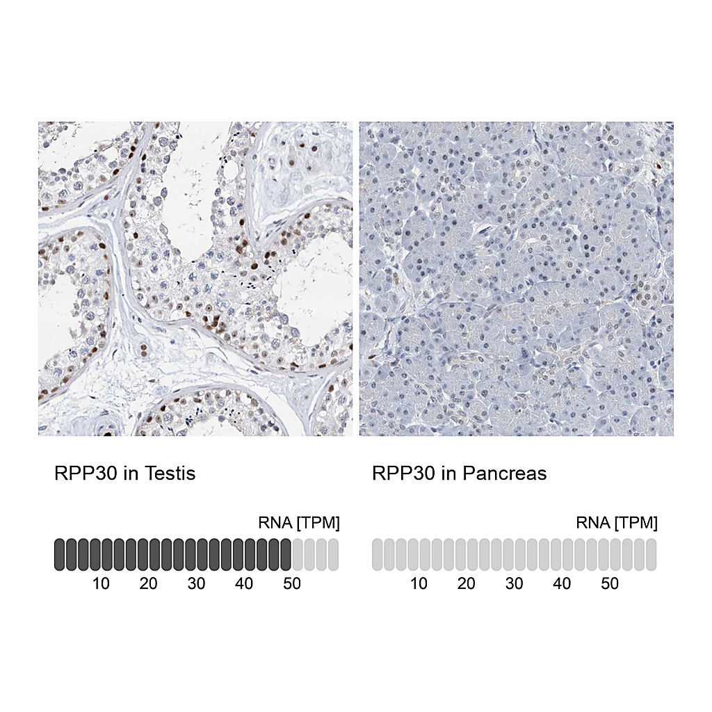 Atlas Antibodies Anti-RPP30 Antibody