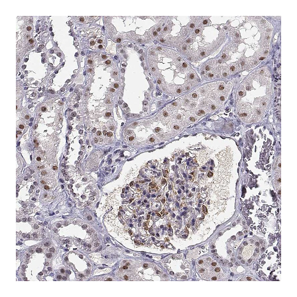 Atlas Antibodies Anti-RPP38 Antibody