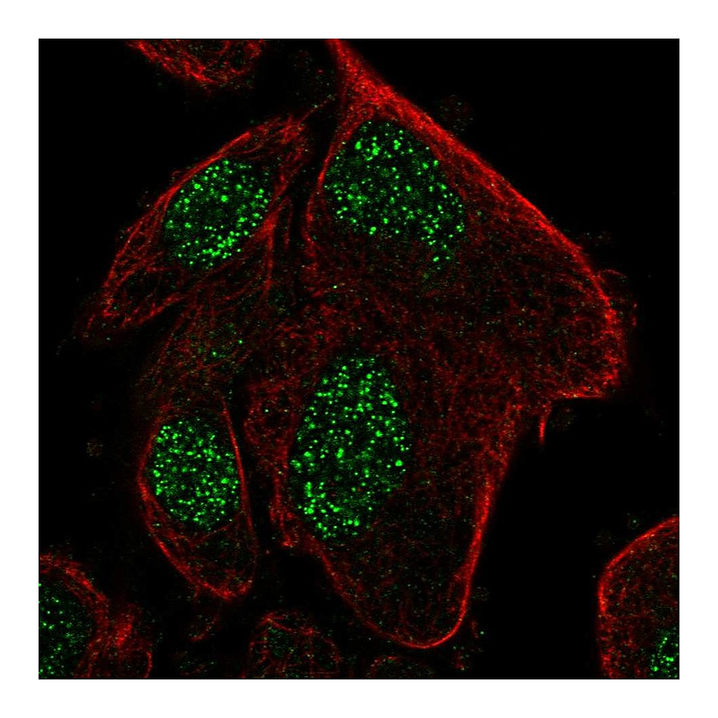 Atlas Antibodies Anti-RPP25L Antibody