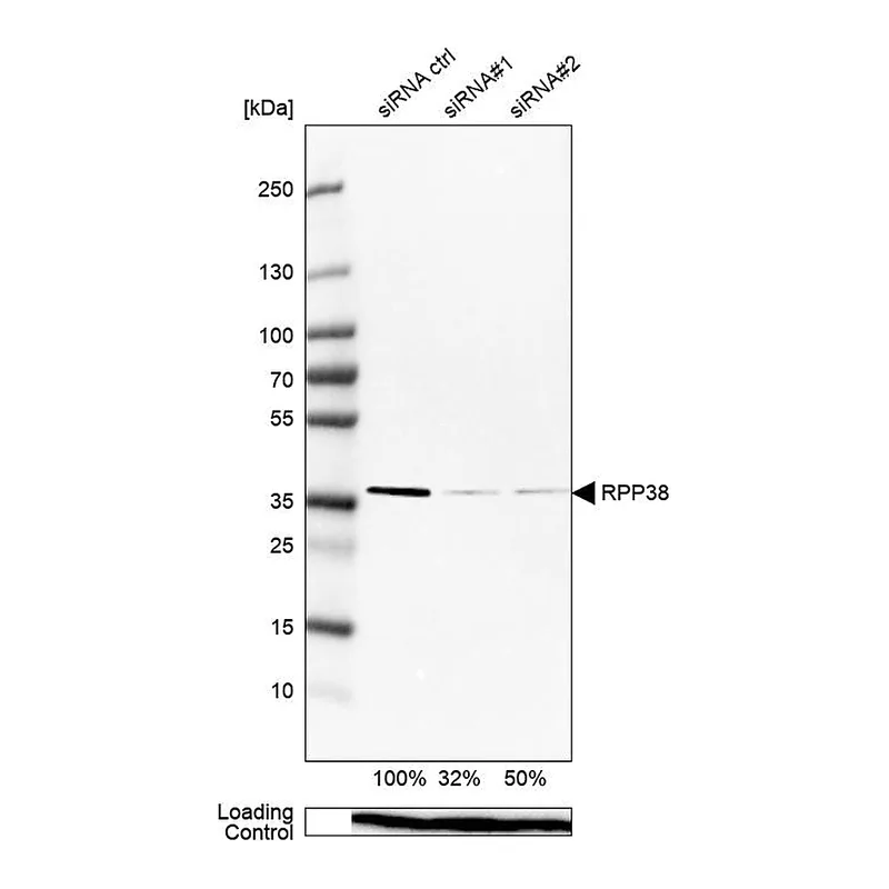 Atlas Antibodies Anti-RPP38 Antibody