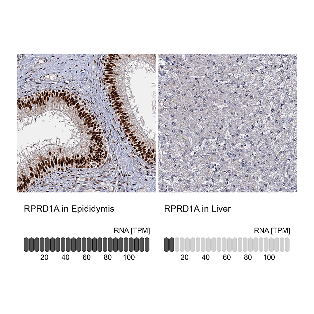 Atlas Antibodies Anti-RPRD1A Antibody