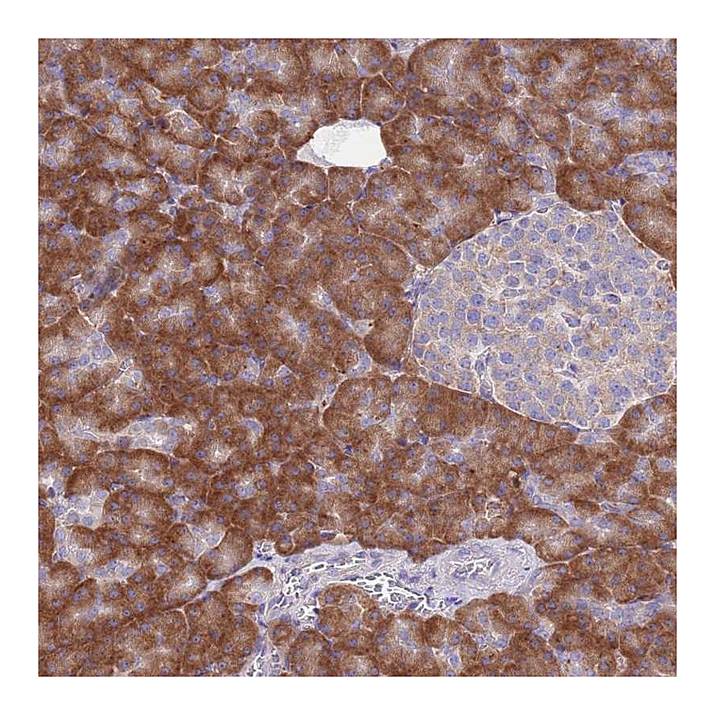 Atlas Antibodies Anti-RPS10 Antibody