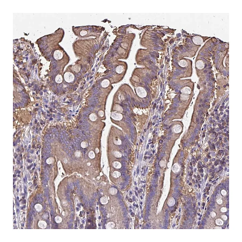 Atlas Antibodies Anti-RPRML Antibody