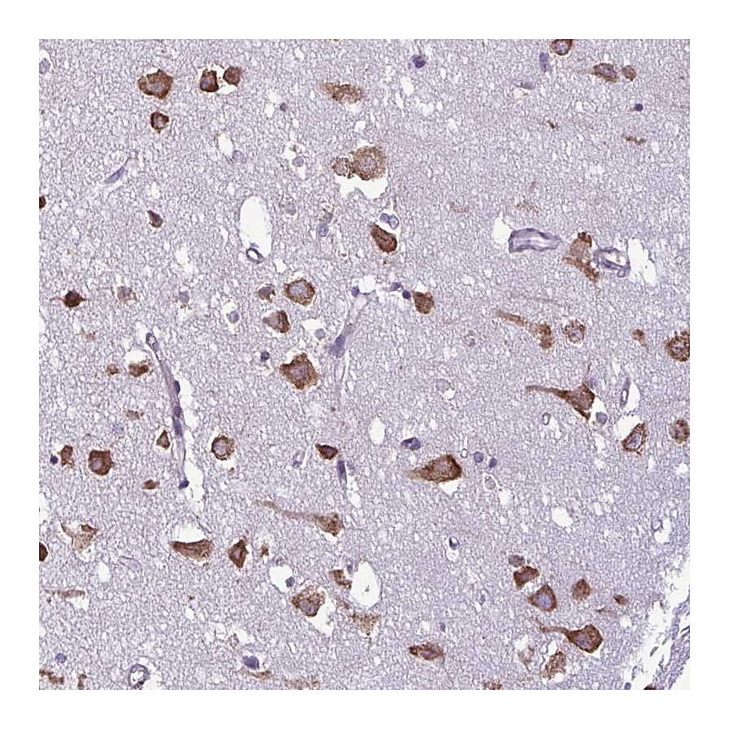 Atlas Antibodies Anti-RPS16 Antibody