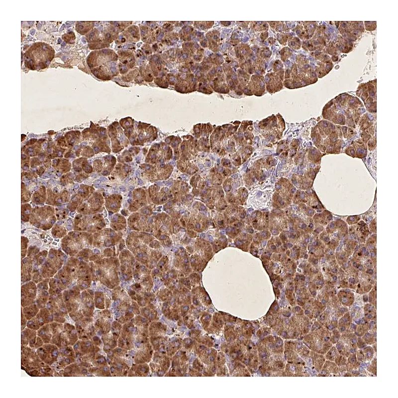 Atlas Antibodies Anti-RPS17 Antibody