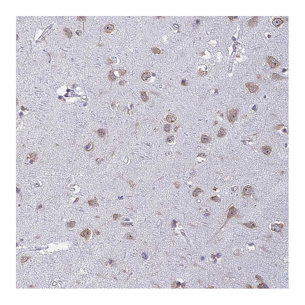 Atlas Antibodies Anti-RPS19BP1 Antibody