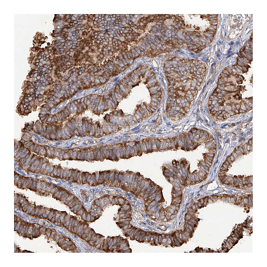 Atlas Antibodies Anti-RPS25 Antibody