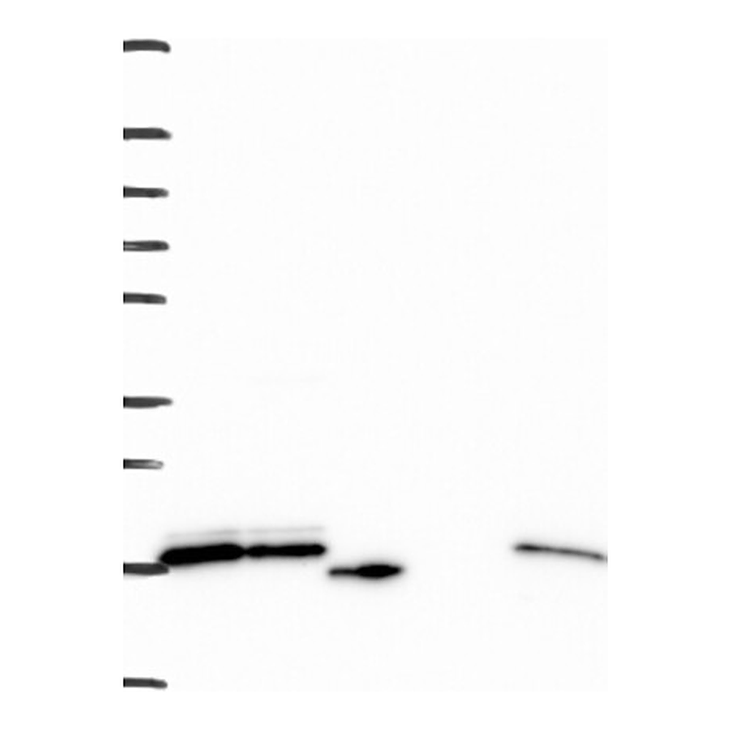 Atlas Antibodies Anti-RPS24 Antibody
