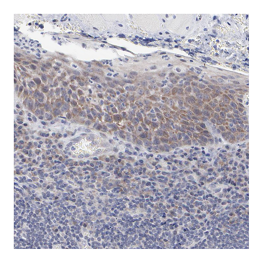 Atlas Antibodies Anti-RPS24 Antibody