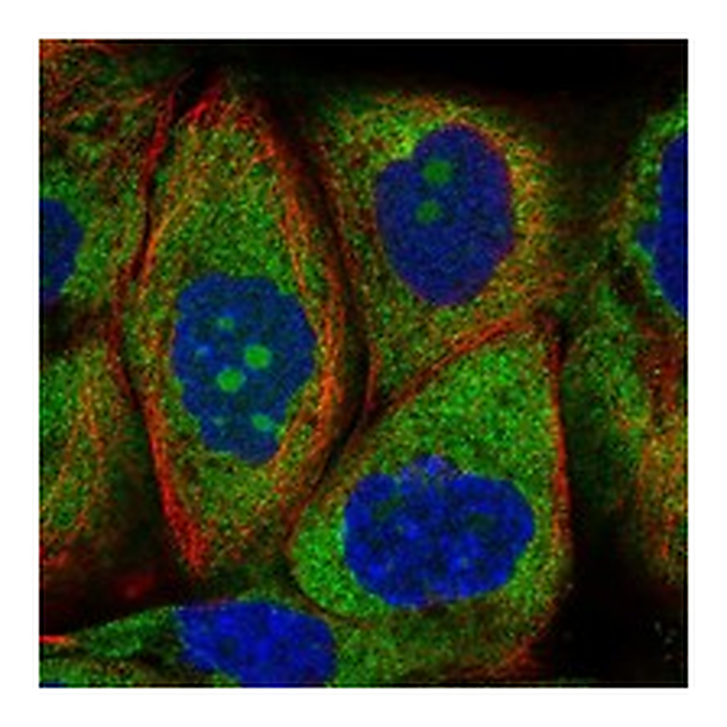 Atlas Antibodies Anti-RPS25 Antibody