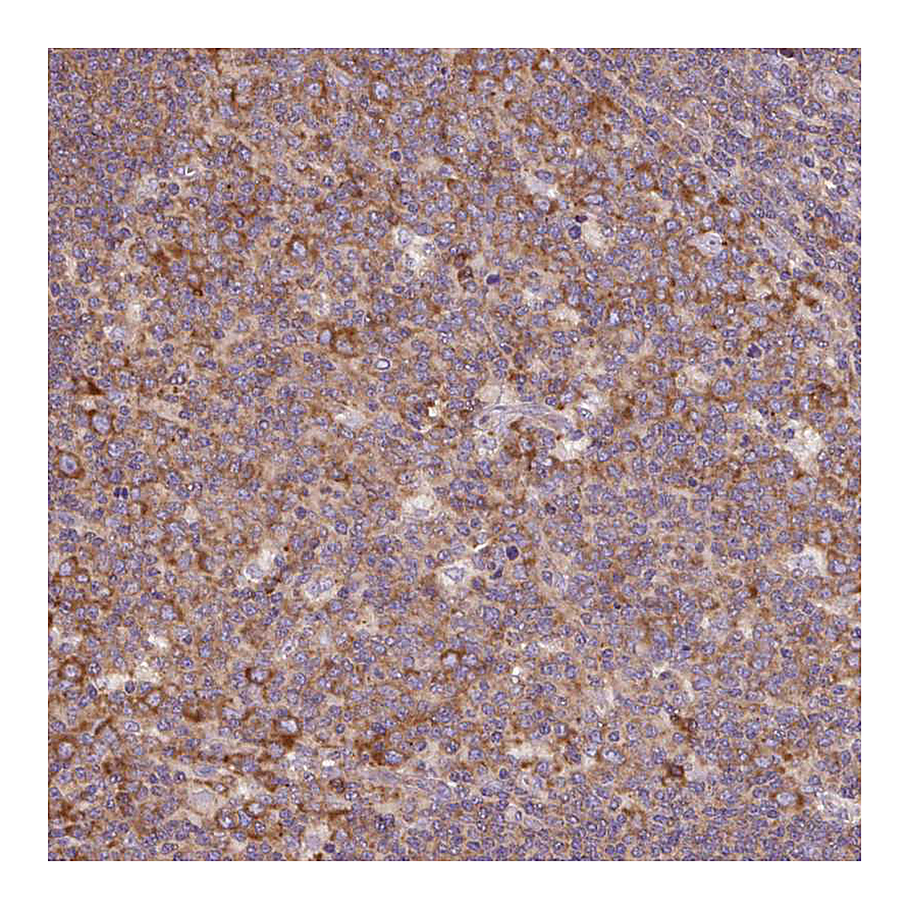 Atlas Antibodies Anti-RPS23 Antibody