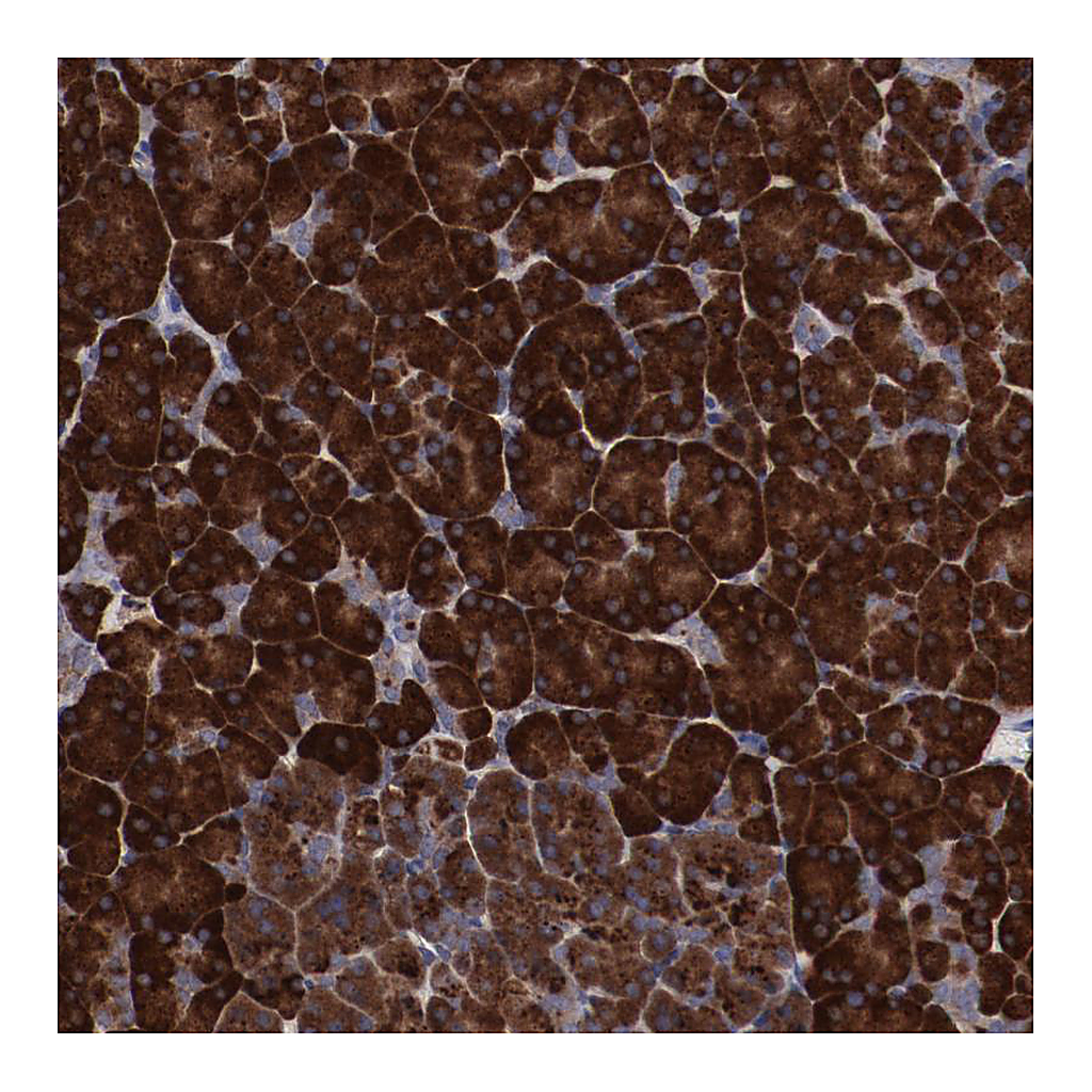 Atlas Antibodies Anti-RPS4X Antibody