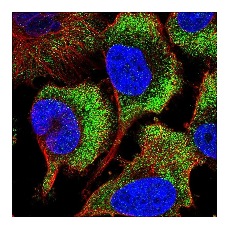 Atlas Antibodies Anti-RPS26 Antibody