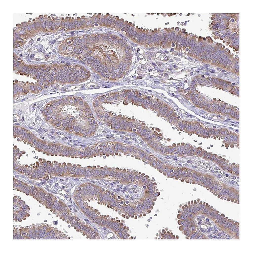 Atlas Antibodies Anti-RPS3 Antibody