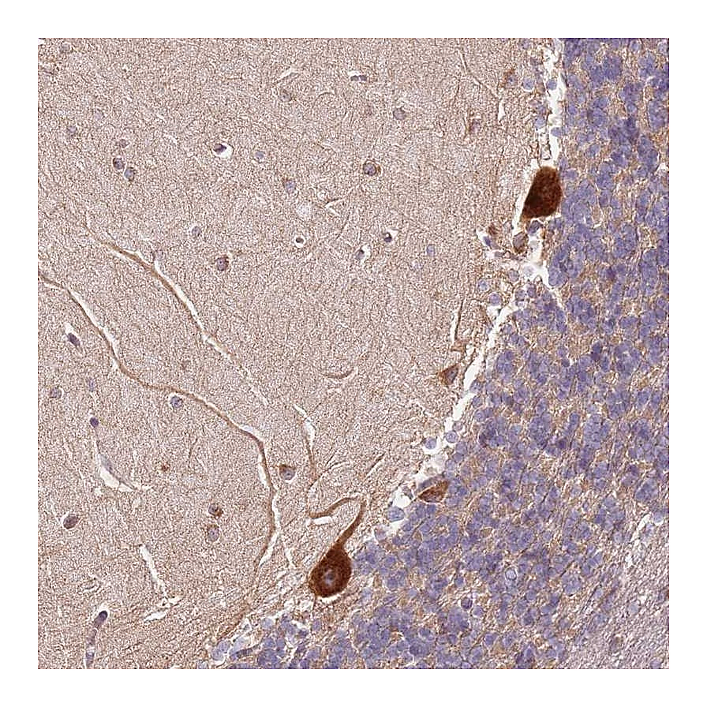 Atlas Antibodies Anti-RPS3A Antibody