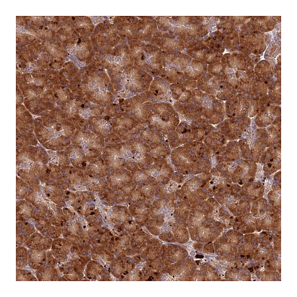 Atlas Antibodies Anti-RPS28 Antibody