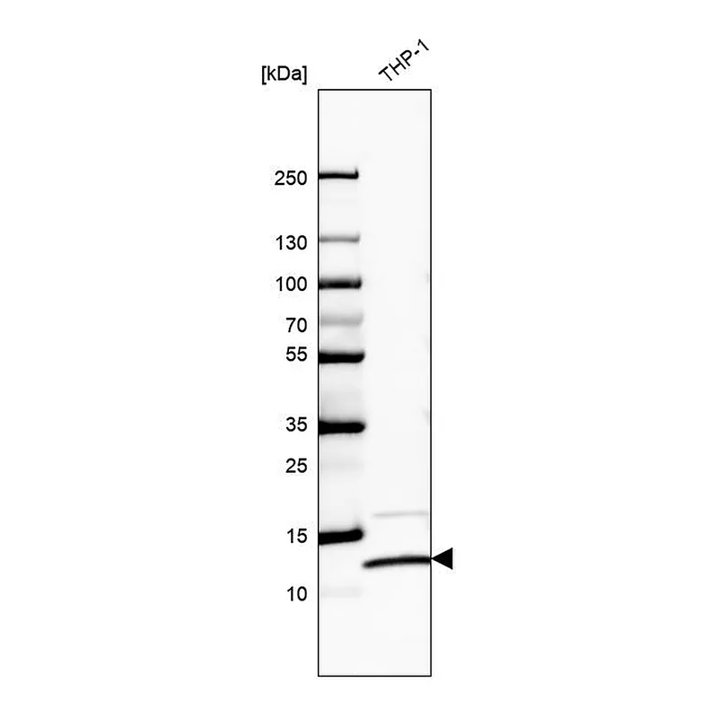 Atlas Antibodies Anti-RPS27L Antibody