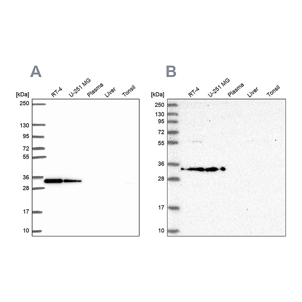 Atlas Antibodies Anti-RPS3A Antibody