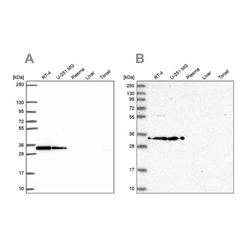 Atlas Antibodies Anti-RPS3A Antibody