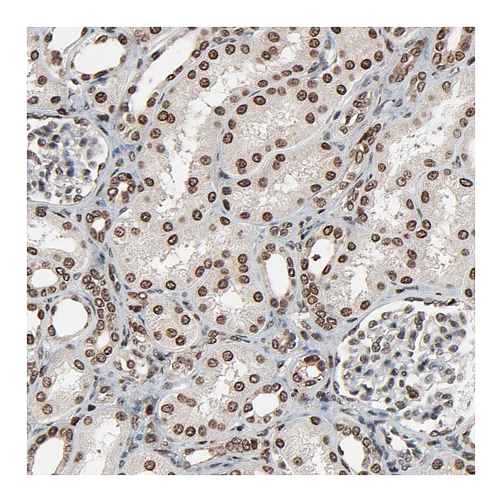 Atlas Antibodies Anti-RPS6KA3 Antibody