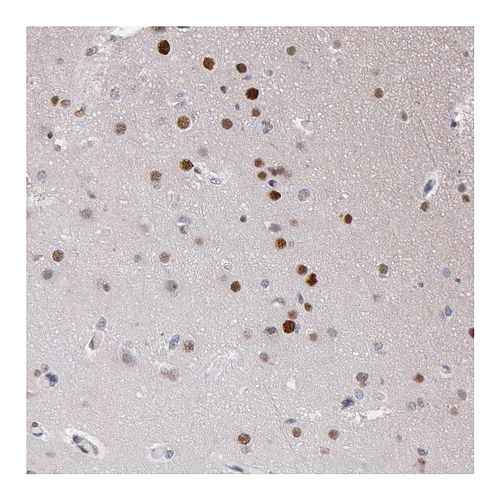 Atlas Antibodies Anti-RPS6KA5 Antibody