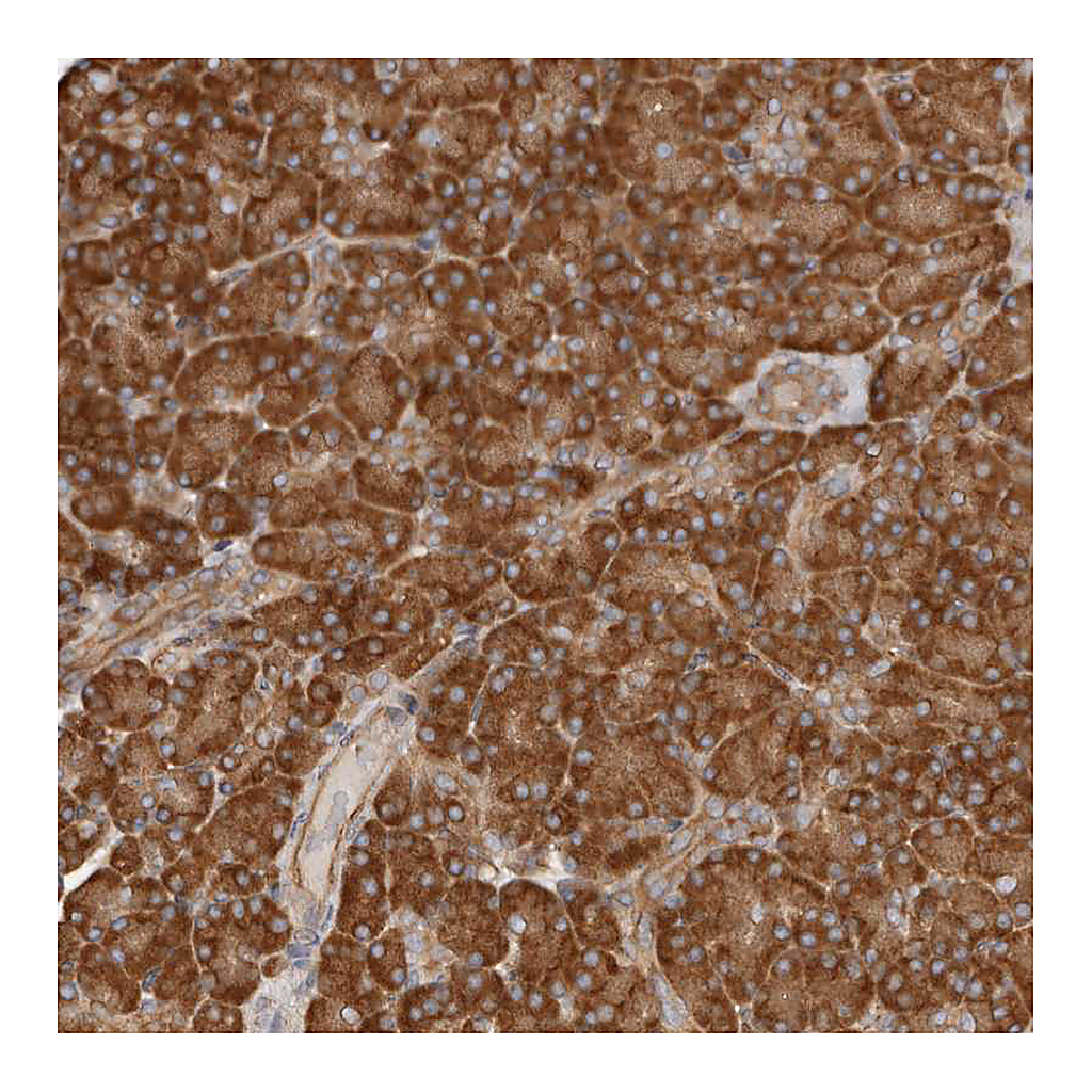 Atlas Antibodies Anti-RPS6 Antibody