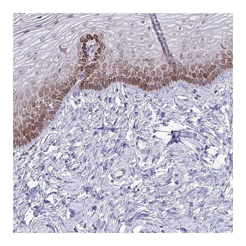 Atlas Antibodies Anti-RPS6KA2 Antibody