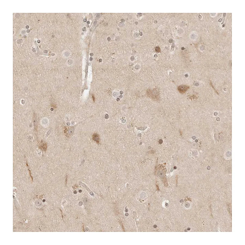 Atlas Antibodies Anti-RPS6KL1 Antibody