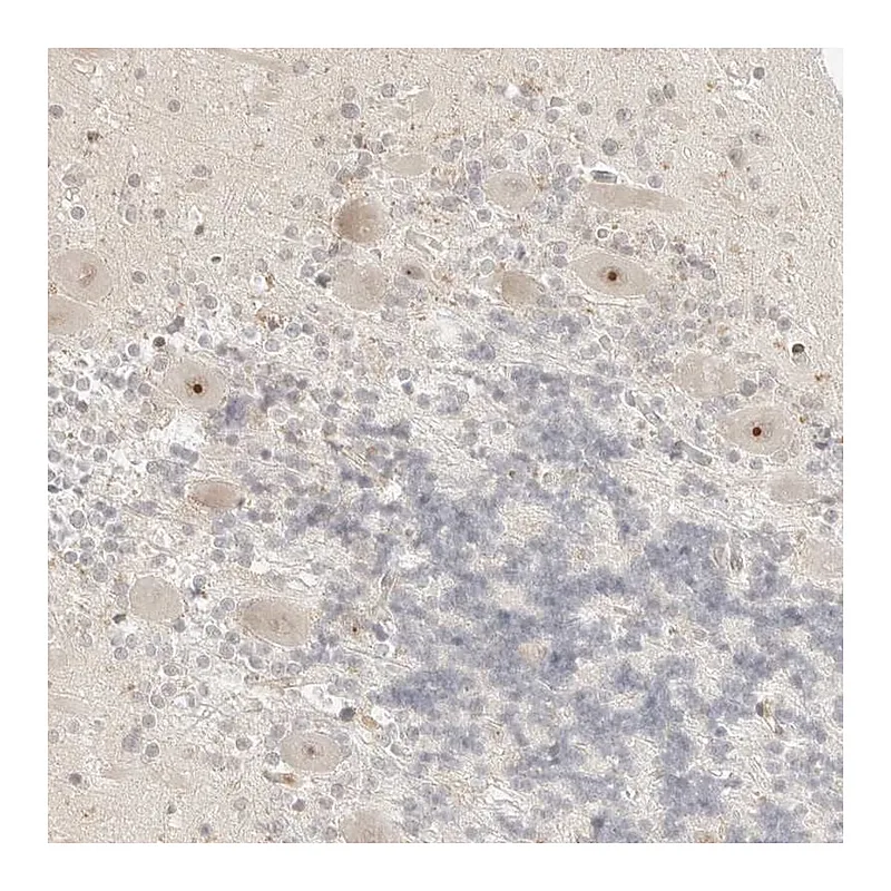 Atlas Antibodies Anti-RPS6KL1 Antibody